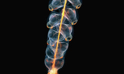 Wanddecoratie Marrus Orthocanna